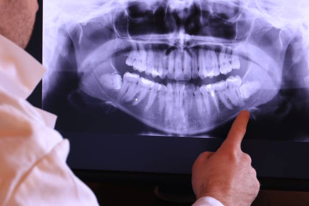 Best Emergency Dentist for Lost Fillings or Crowns in Duchesne, UT